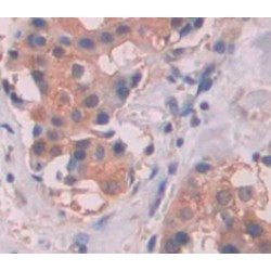 Alpha-1-B Glycoprotein (A1BG) Antibody