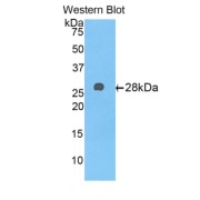 abx102205