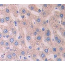 Alpha-1-B Glycoprotein (A1BG) Antibody