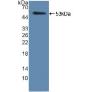 Western blot analysis of recombinant Human ELA2.