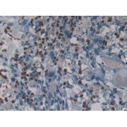 Neutrophil Elastase / ELA2 (ELANE) Antibody
