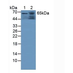 Lysosomal Alpha Glucosidase (GAA) Antibody