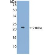 Western blot analysis of recombinant Human GaA.