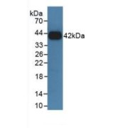 Western blot analysis of recombinant Rat GHR.
