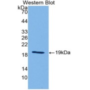 Western blot analysis of the recombinant protein.