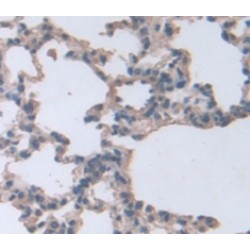 Sonic Hedgehog Protein (SHH) Antibody