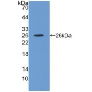 Western blot analysis of recombinant Rat IL4R.