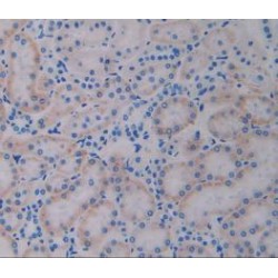 Interleukin 4 Receptor (IL4R) Antibody