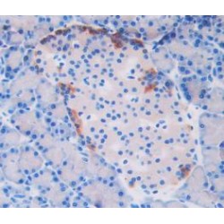 Interleukin 4 Receptor (IL4R) Antibody