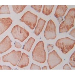 Interleukin 4 Receptor (IL4R) Antibody