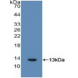 Interleukin 6 Receptor (IL6R) Antibody