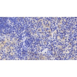 Interleukin 6 Receptor (IL6R) Antibody
