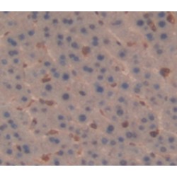 Interleukin 6 Receptor (IL6R) Antibody