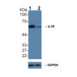 Interleukin 7 Receptor (IL7R) Antibody
