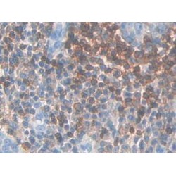 Interleukin 7 Receptor (IL7R) Antibody
