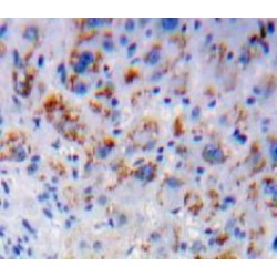 Interleukin 7 Receptor (IL7R) Antibody