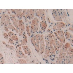 Myosin Heavy Chain 16 (MYH16) Antibody