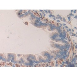 Prolylcarboxypeptidase (PRCP) Antibody