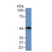 Western blot analysis of Human Lung lysate, using Human TACR2 Antibody (1 µg/ml) and HRP-conjugated Goat Anti-Rabbit antibody (<a href="https://www.abbexa.com/index.php?route=product/search&amp;search=abx400043" target="_blank">abx400043</a>, 0.2 µg/ml).