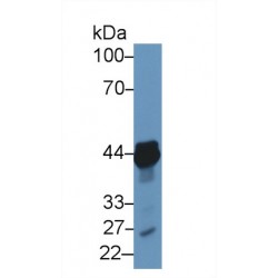 Tachykinin Receptor 2 (TACR2) Antibody