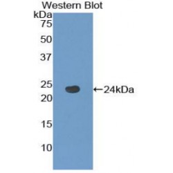 Tachykinin Receptor 2 (TACR2) Antibody