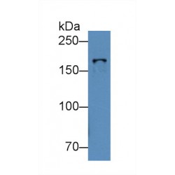 Topoisomerase II Beta (TOP2b) Antibody