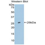 Western blot analysis of recombinant Mouse TOP2b.