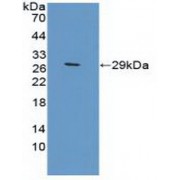 Western blot analysis of recombinant Mouse TFR2.
