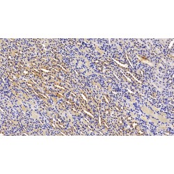 Alanine Aminotransferase 1 / ALT (GPT) Antibody