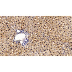 Alanine Aminotransferase 1 / ALT (GPT) Antibody