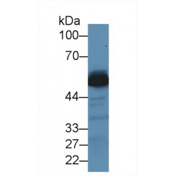 Alanine Aminotransferase 1 (GPT) Antibody