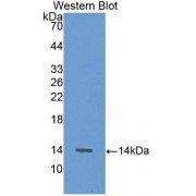 Western blot analysis of recombinant Human ALT protein.