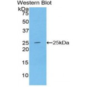 Western blot analysis of recombinant Human ADH1.