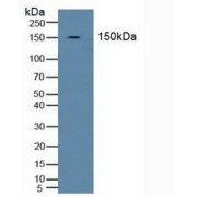 Western blot analysis of Human Blood Cells.