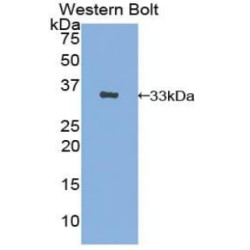 Anion Exchange Protein 1 (AE1) Antibody