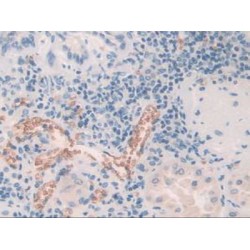 Anion Exchange Protein 1 (AE1) Antibody