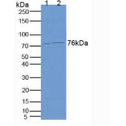 Carcinoembryonic Antigen-Related Cell Adhesion Molecule 5 (CEACAM5) Antibody