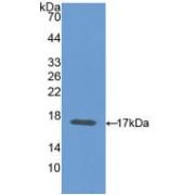 Western blot analysis of recombinant Mouse CEA.