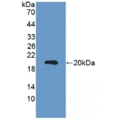 Carcinoembryonic Antigen-Related Cell Adhesion Molecule 5 (CEACAM5) Antibody