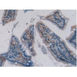 Carcinoembryonic Antigen-Related Cell Adhesion Molecule 5 (CEACAM5) Antibody