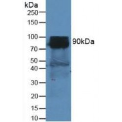 Dipeptidyl Peptidase 4 / CD26 (DPP4) Antibody