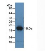 Western blot analysis of recombinant Mouse DPP4.