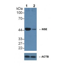 Enolase, Neuron Specific (NSE) Antibody