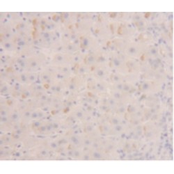 Enolase, Neuron Specific (NSE) Antibody