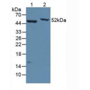Western blot analysis of (1) Mouse Brain Tissue and (2) Human HeLa cells.