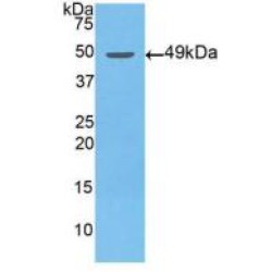 Gamma-Enolase (ENO2) Antibody