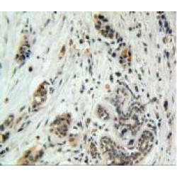 Gamma-Enolase (ENO2) Antibody