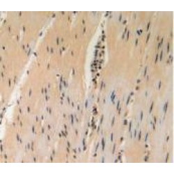 Gamma-Enolase (ENO2) Antibody