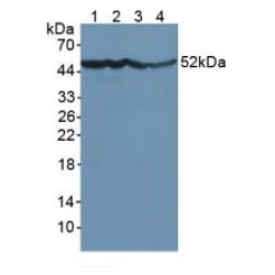Gamma-Enolase (ENO2) Antibody