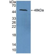 Western blot analysis of recombinant Rat ENO2.